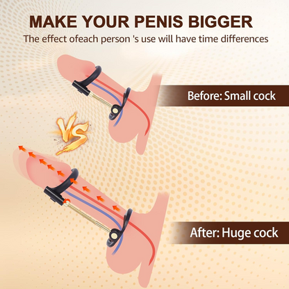 Dr. Aaron Penis Extender