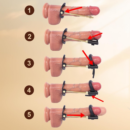 Dr. Aaron Penis Extender Sirr