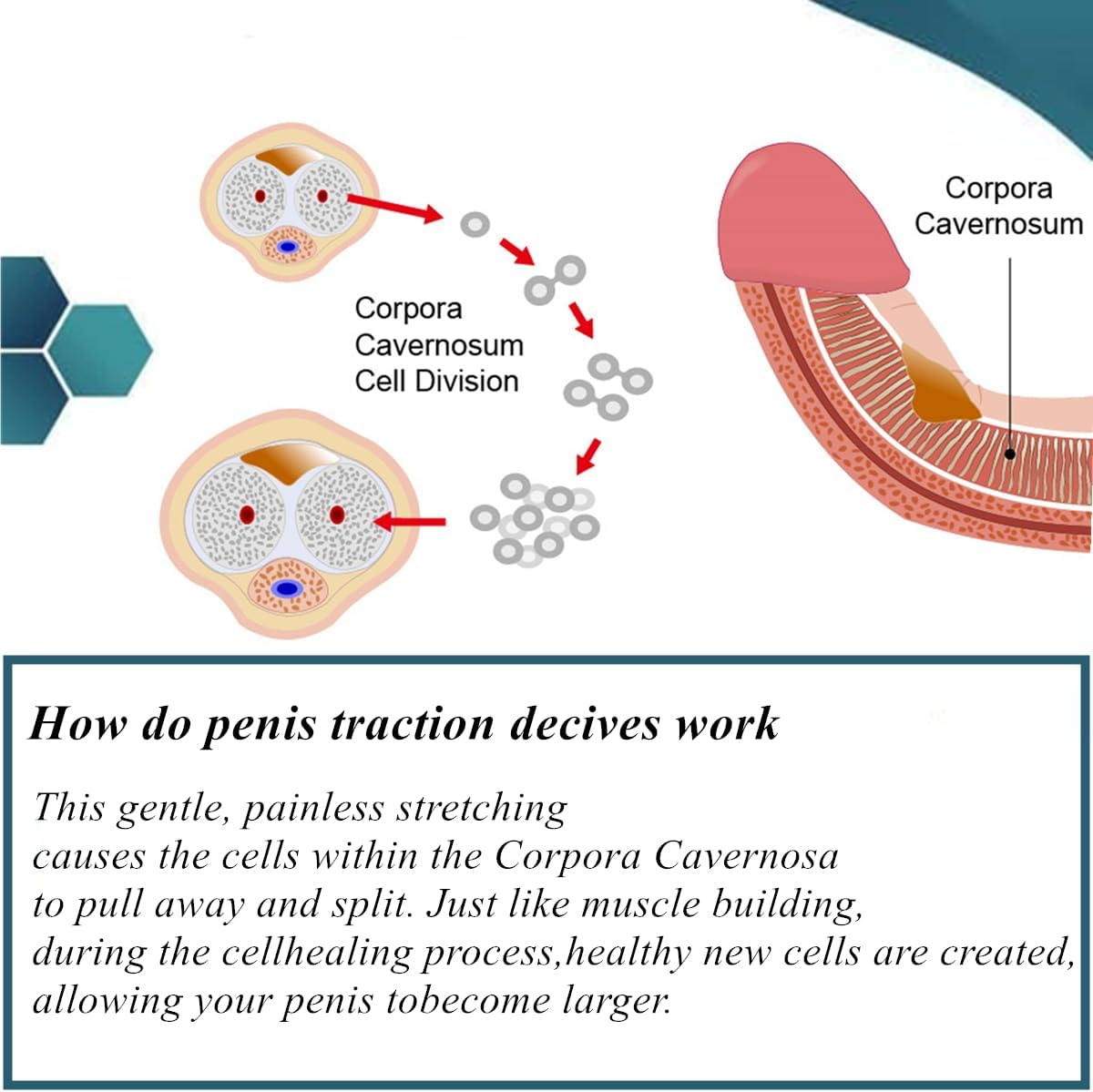 Dr. Aaron Penis Extender